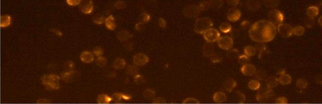 Immunfluoreszenzfärbung zum Nachweis des Antigens Melanomaassociated Chondroitin Sulfate Proteoglycan (MCSP) durchgeführt.