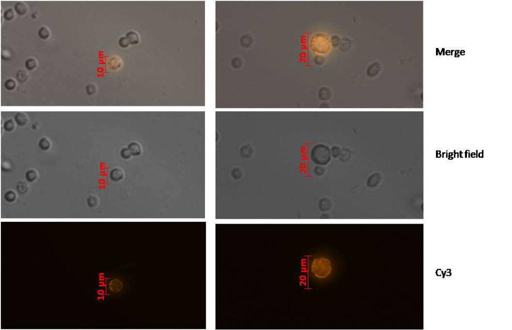 3.2.1.2 Unterscheidung MCSP-positiver Zellen nach ihrer Morphologie Beim Mikroskopieren der Zellsuspensionen fiel die heterogene Morphologie MCSPpositiver Zellen auf.