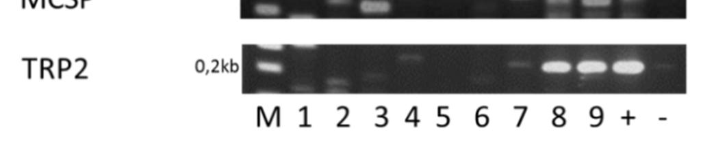 14 PCR zum Nachweis der Expression der Markergene für ausdifferenzierte Melanozyten und Zellen des malignen Melanoms Neben dem Marker (1kb-Leiter) sind von links nach rechts die PCR-Amplifikate der