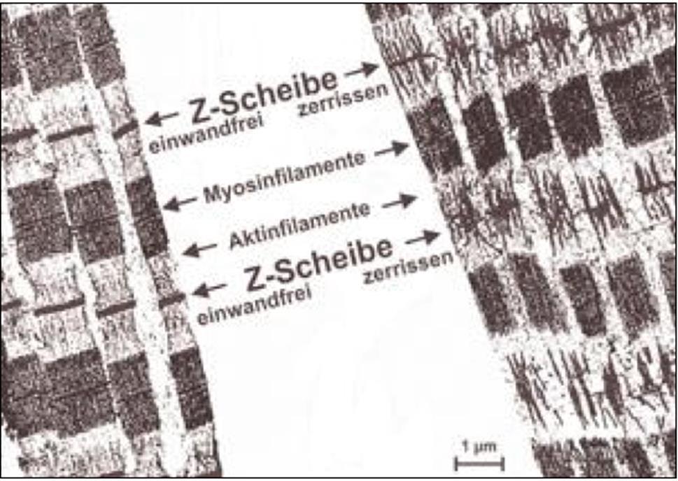 Gefahren des Krafttrainings aus gesundheitlicher Sicht: Muskelkater 37