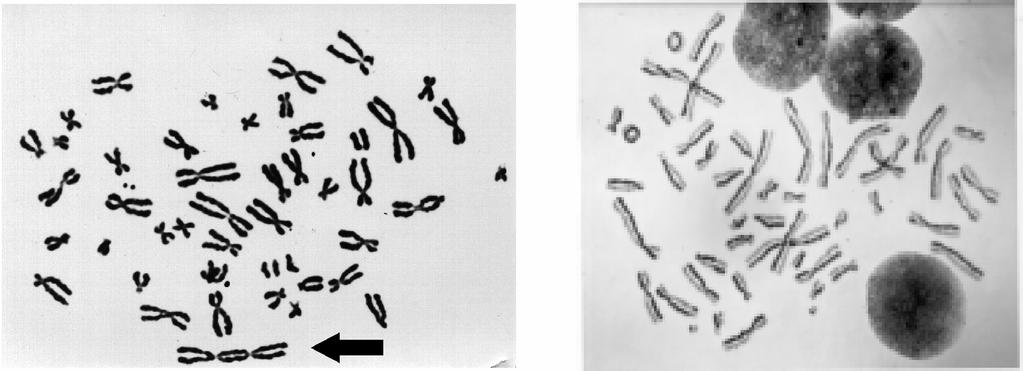 Abbildung 21: Links: Menschlicher Lymphozyt im ersten Zellteilungszyklus in vitro (Pfeil zeigt auf ein dizentrisches Chromosom).