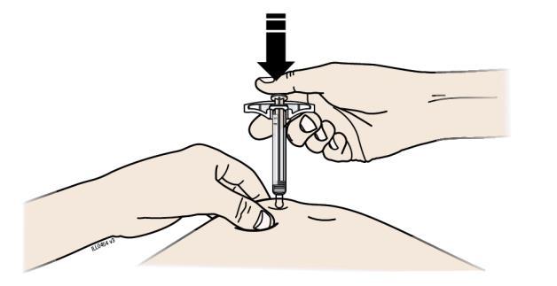 bilden. Wichtig: Halten Sie die Haut während der Injektion zusammengedrückt. Schritt 3: Injektion G.