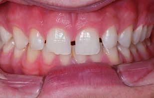Als Vitique-Verwender erhalten Sie ermäßigte Konditionen für den Kurs»Ästhetische Zahnmedizin professionell fotografiert«.