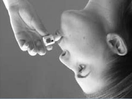 7. Inhalieren - Neigen Sie den Kopf leicht nach hinten. - Führen Sie den nach unten geneigten Inhalator in den Mund ein, und umschließen Sie das Mundstück fest mit den Lippen.