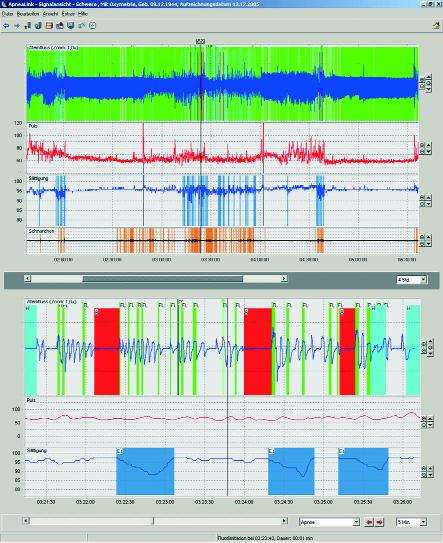 Die genauen Signaldaten Jeder Atemzug wird registriert.