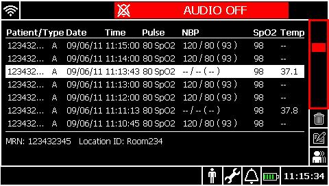 Netzkontrolllämpchen Akku-Statuslämpchen Benutzeroberfläche Der SureSigns VSi Monitor hat zwei Bild-Layouts: Vitalparameter und Patienten-Datensätze.
