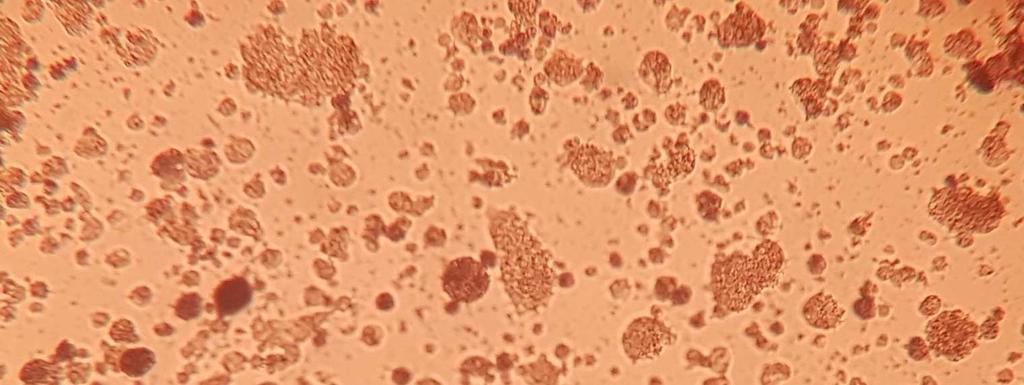 Montana murine Makrophagen (MM-Zellen), LMH