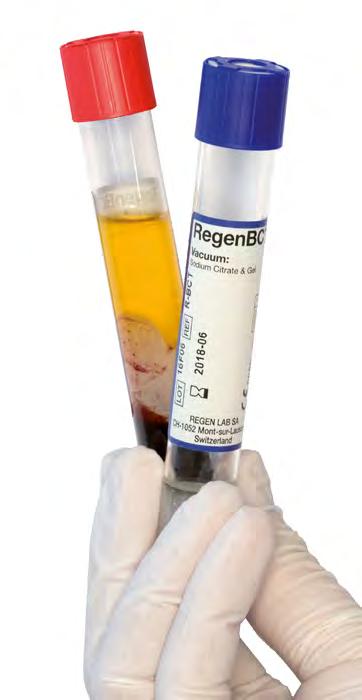 RegenKit A-PRP Plus Autologes Thrombin Serum