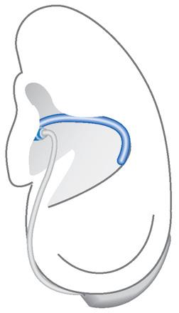 Die optionale Concha-Abstützung hilft, den Sitz des Ohrstücks im Ohr zu verbessern.