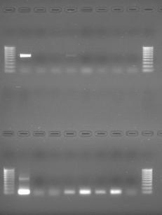 Ergebnisse 107 M 1 2 3 4 5 6 7 8 M A CT BA DA WK T PCR 80/640 M 1 2 3 4 5 6 7 8 M A CT BA DA WK T Nested-PCR 525/640 Abbildung 38: Gelelektrophoretische Auftrennung der PCR-Produkte mit den Proben