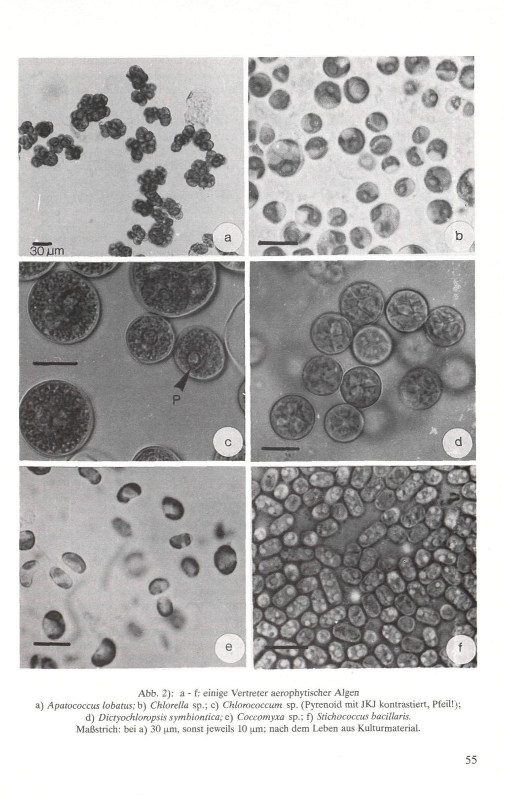 Abb. 2): a - f: einige Vertreter aerophytischer Algen a) Apatococcus lobatus; b) Chlorella sp.; c) Chlorococcum sp. (Pyrenoid mit JKJ kontrastiert, Pfeil!