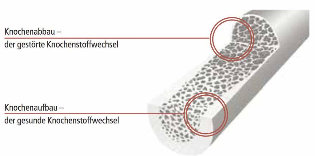 Wie der Knochenstoffwechsel funktioniert.