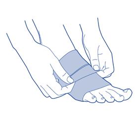 Artroza stopala: liječenje i prevencija