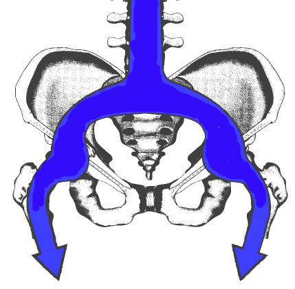 3 Anatomie 3.1 Anatomie des Beckenringes und des Azetabulums 3.1.1 Beckenring Der Beckenring wird durch eine komplexe knöcherne Struktur, die die Beckenknochen mit der Wirbelsäule zu einem stabilen Ring zusammenfasst gebildet.