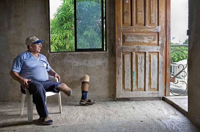 Kolumbien: Minenopfer (Handicap International) Weshalb tritt bei Handicap International die Antiminenarbeit etwas in den Hintergrund und fokussieren Sie sich neu auf Bombenabwürfe auf Zivilpersonen