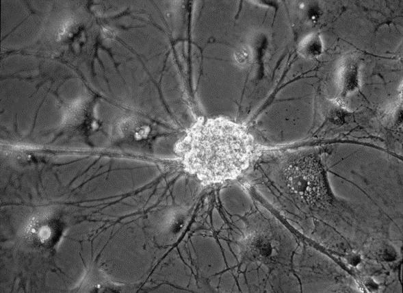 Menschliche neuronale Kulturmodelle Zelllinienmodell: Humane Modellneurone (NT2-N Zellen)