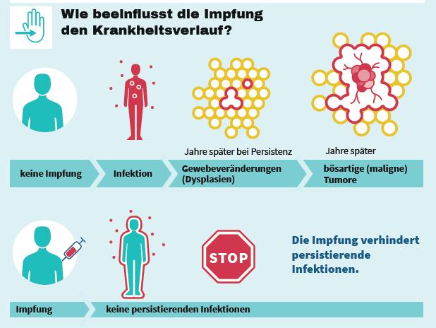 HPV-Impfung Quelle RKI Uniklinik RWTH Aachen,