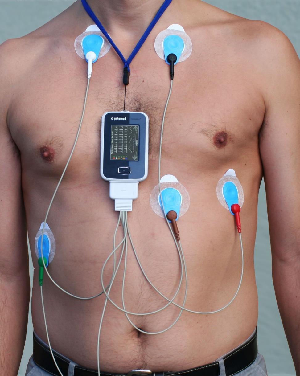 Diagnose Holter EKG Kleines tragbares Gerät Bandaufzeichnung eines EKGs über längere Zeit Rhythmusstörungen während dem Alltag Elektroden an Körper