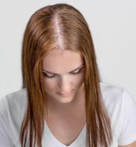MicroLines Die Lösung für feines und schütteres Haar! 10 GRÜNDE, WARUM MICROLINES DIE NR.