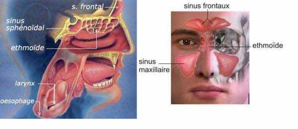 Nasennebenhöhlenkrebs Das Karzinom der Nasenhöhlen, des Siebbeins und der anderen Hohlräume im Gesicht kommt selten vor, Häufigkeit in Frankreich 60-80 Fälle/Jahr.