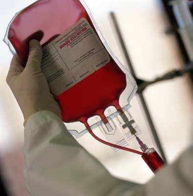Überwachung der Filtrationszeiten von Blutpräparaten paraten