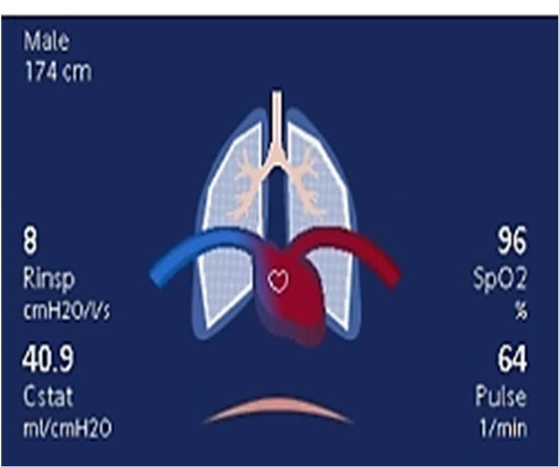 Was ist der HLI? 1. Der HLI-Index stellt die Herz-Lungen- Interaktion dar, die durch eine automatisierte Analyse der Pulsoxymetriekurven und der bekannten Pulsdruckschwankungen berechnet wird. 2.