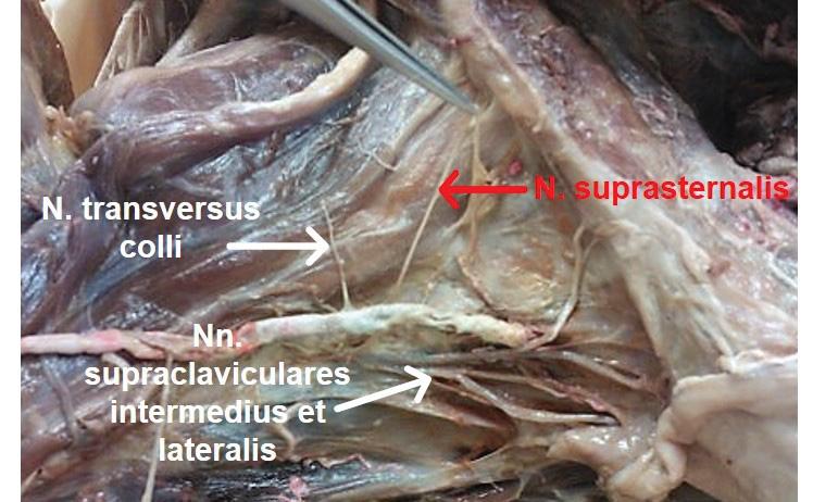 Dieser Nerv durchbrach die Fascia prevertebralis unmittelbar am Hinterrand des M. sternocleidomastoideus und immer kranialer als die beiden anderen Nn. supraclaviculares.