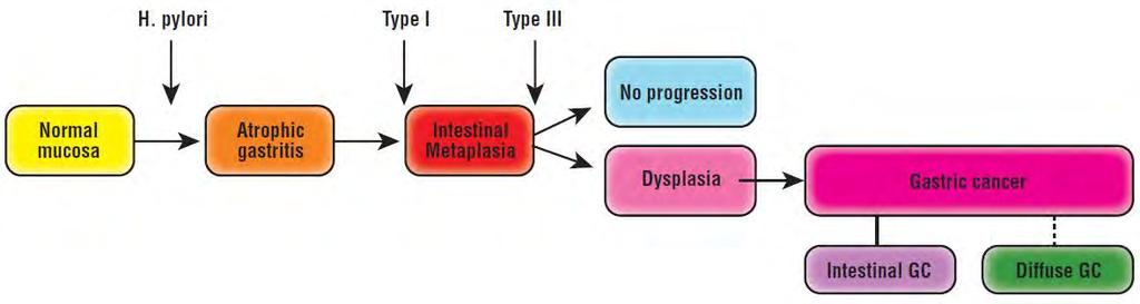 Premalignant stages of gastric cancer Busuttil