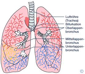 Chronische Bronchitis Die chronische Bronchitis gehört zu den häufigsten Erkrankungen (15-25%).