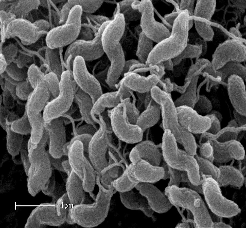 Campylobacter sind mikroaerophile Bakterien (Wachstum nur unter reduzierter O 2 Atmosphäre,