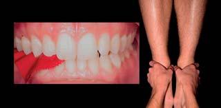 Anwenderbericht Diagnostik in der Zahnmedizin Zahnmedizin onsstörungen (20 Prozent) der Füße (Knick-, Spreiz- oder Senkfuß) und Blockaden der Wirbelsäule können Änderungen der UK-Position und dadurch