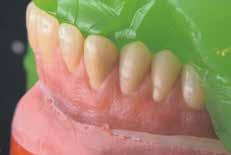 Dentalgipse, gipshaltige und phosphatgebundene