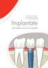Mit freundlicher Unterstützung von Ihrem Zahnarzt- Team und Chlorhexamed. Implantate. Informationen rund um Ihr Implantat