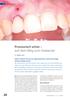 Der provisorische oder temporäre Zahnersatz dient. Provisorisch schön auf dem Weg zum Implantat. Steffen Hohl. Implantologie