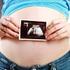 Schwangerschaft und Geburt (Leitfaden für Bonn)