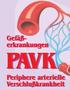Gefäßerkrankungen PAVK. Periphere arterielle Verschlußkrankheit