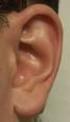 Ohr I: Anatomie, Physiologie, Erkrankungen des äußeren Ohres, akute Otitis media