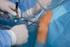 Was kann eine Kniearthroskopie verbessern?