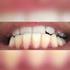 Hallo! Alle deine Zähne: Wo sitzt welcher Zahn? Die 20 Kinderzähne Die 32 Erwachsenenzähne Die Schneidezähne Die Eckzähne Die Backenzähne