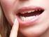 Bei schmerzhaften Entzündungen im Mund und Rachen