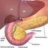 Tumoren der endokrinen Organe