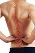 Dabei kommt es in etwa einem Drittel der akuten Rückenschmerzfälle zur Chronifizierung.