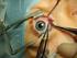 Schielen Einführung  Die Entwicklung der Sehschärfe Die verschiedenen Formen des Schielens