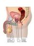 Die Prostata: Anatomie und Funktion