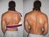 Krafttraining bei Rückenschmerzen und nach Operationen