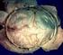 Neuroanatomie. Hüllen des ZNS (Meningen) & Liquor cerebrospinalis