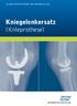 KLINIK FÜR ORTHOPÄDIE UND TRAUMATOLOGIE. Kniegelenkersatz (Knieprothese)