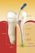 Endodontie. Zahnerhalt durch Wurzelbehandlung
