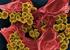 Methicillin-resistente Staphylococcus aureus (MRSA) Empfehlungen für Alten- und Pflegeeinrichtungen Stand: Juli 2013