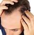 Haarausfall? Dünner werdendes Haar? Ein Ratgeber für Patientinnen mit Haarausfall oder dünnem, brüchigem Haar